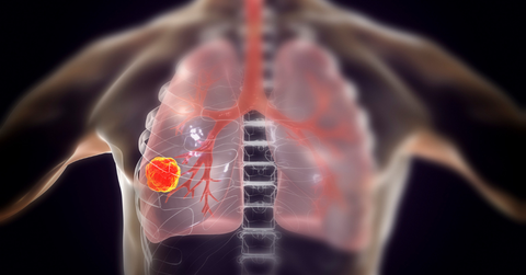 Lung Disorders